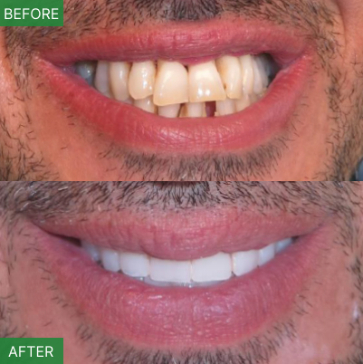 Nj Implant Dentist – Dr. Arnold Do | All-on-4 & Full Arch Expert photo 2