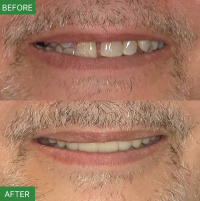 Nj Implant Dentist – Dr. Arnold Do | All-on-4 & Full Arch Expert photo 3