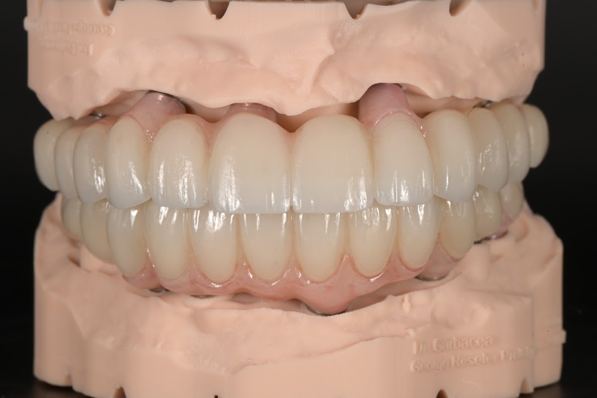Prosthodontics & Implant Dentistry Of Laguna Hills photo 1