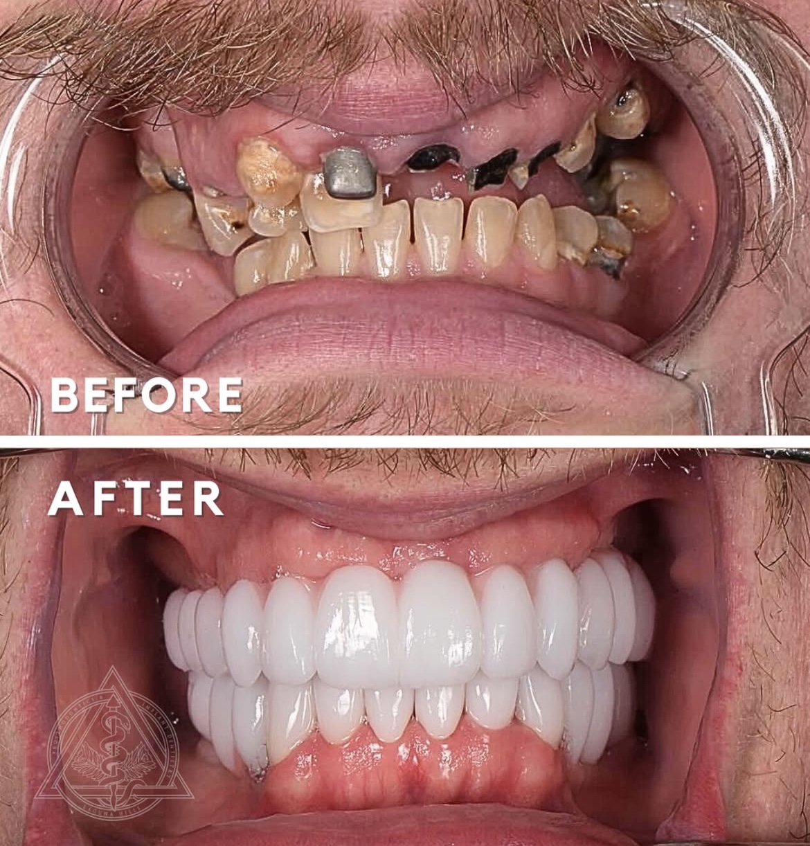 Prosthodontics & Implant Dentistry Of Laguna Hills photo 3