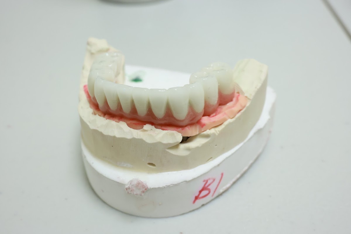 Smile Care - Sc Dental Group Family Invisalign Emergency Dental Implants photo 6
