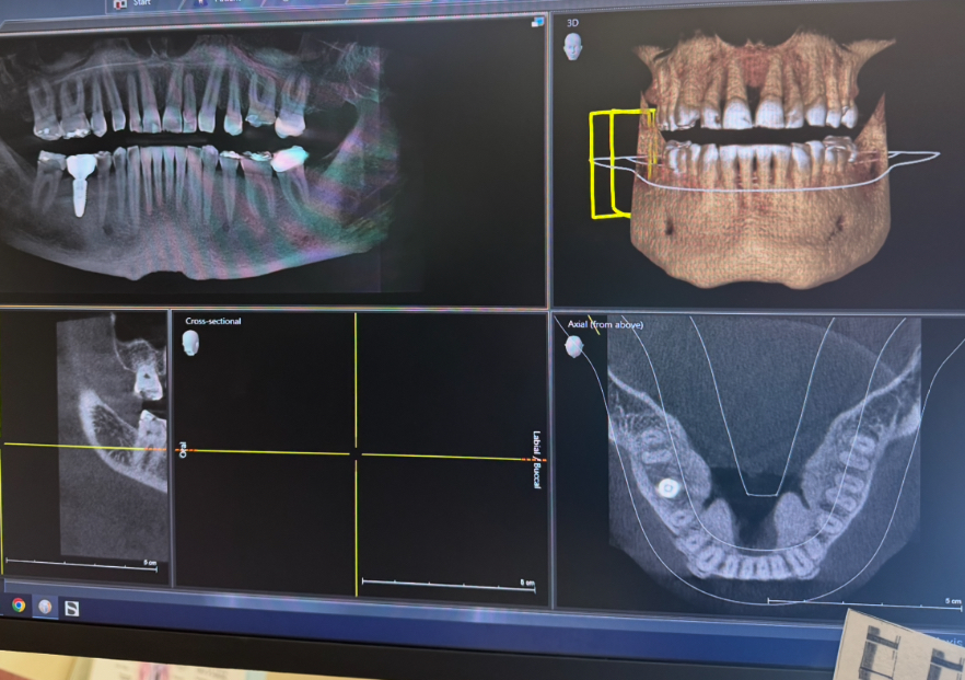 The Center For Implant & General Dentistry photo 3