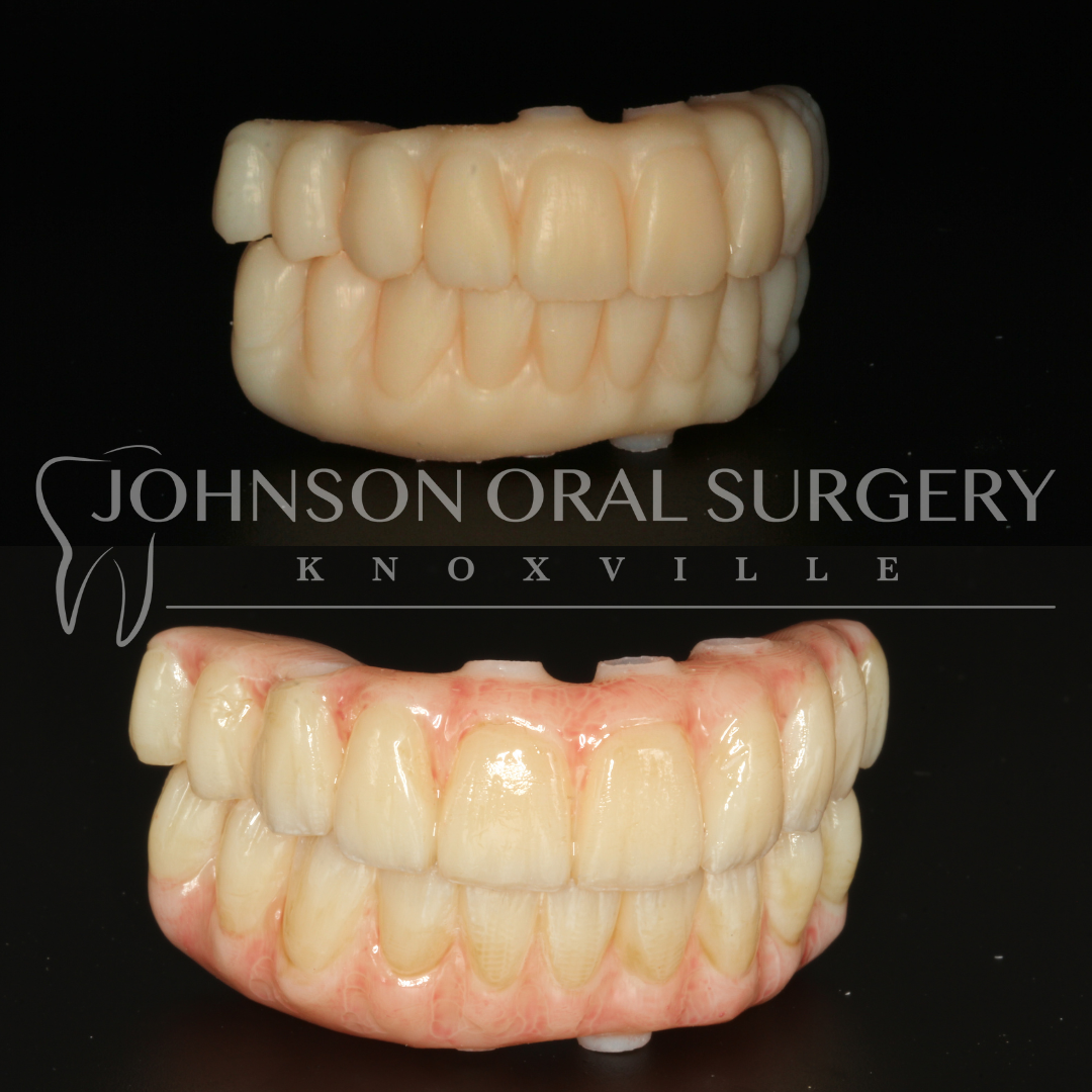 Johnson Oral Surgery Knoxville photo 2