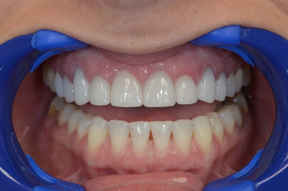 Advanced Family Dentistry photo 6