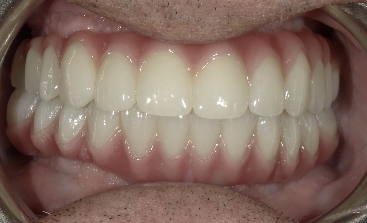 Laurel Bowie Implant & Cosmetic Dentistry photo 1