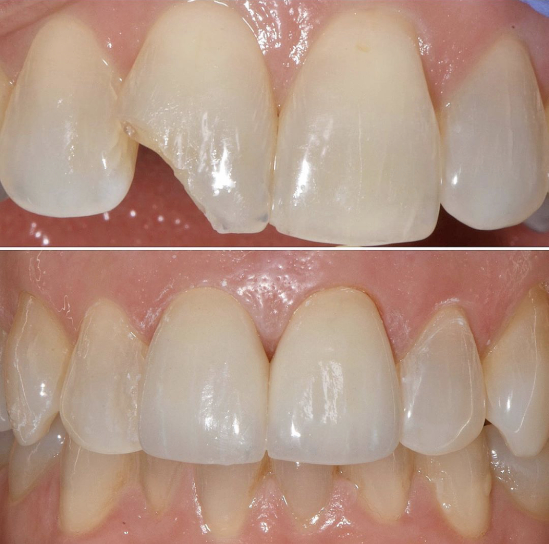 Laurel Bowie Implant & Cosmetic Dentistry photo 3