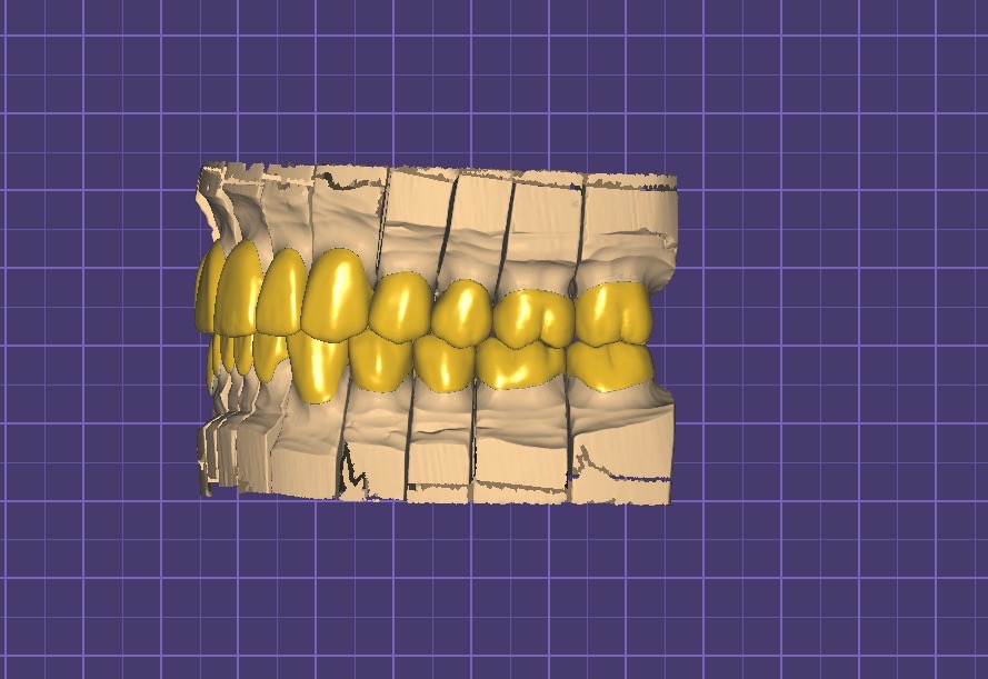 Prosthetica Digital photo 1