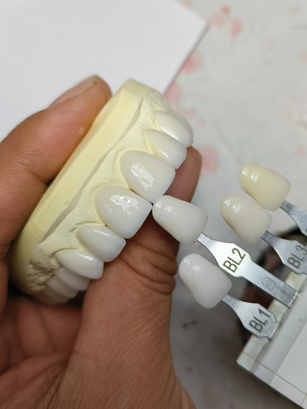 Prosthetica Digital photo 2