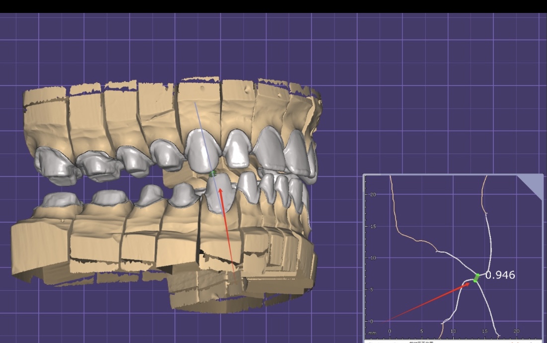 Prosthetica Digital photo 3