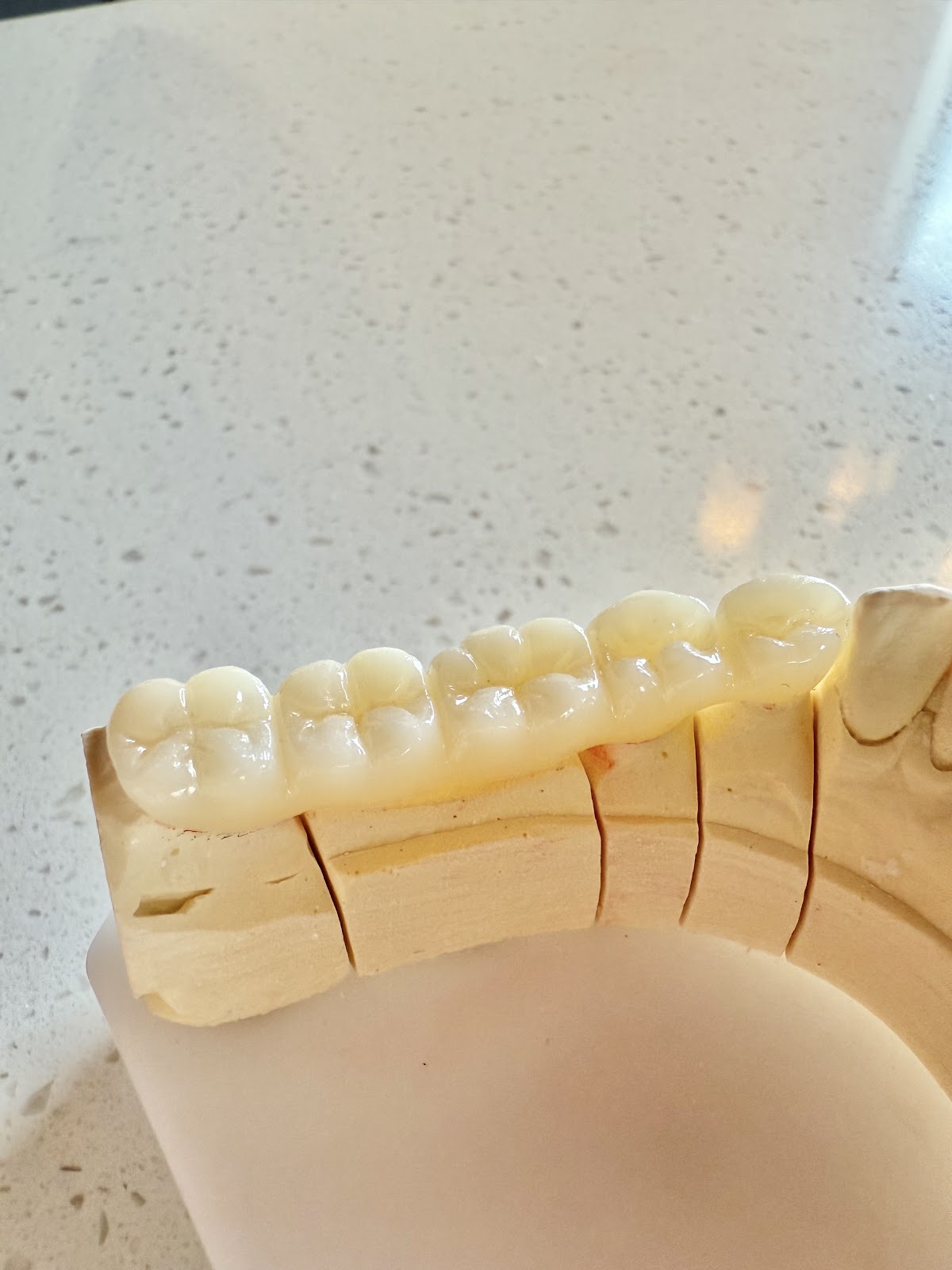 Prosthetica Digital photo 4