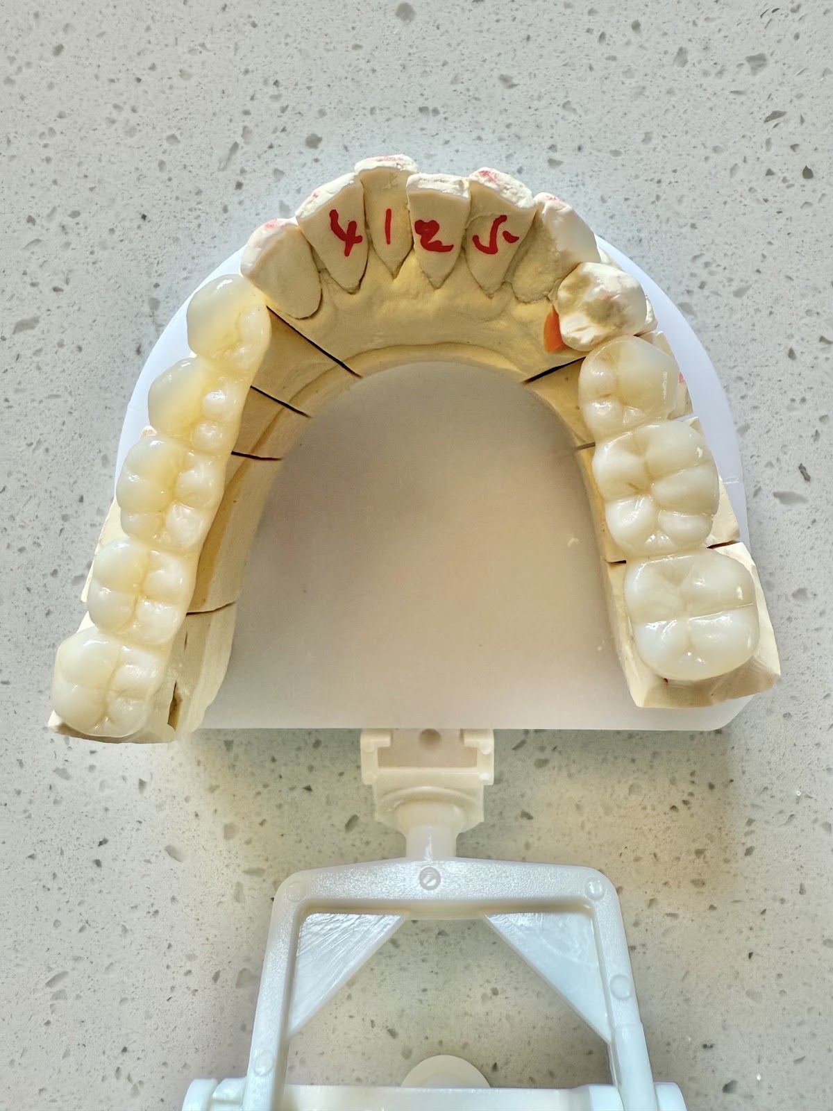 Prosthetica Digital photo 6
