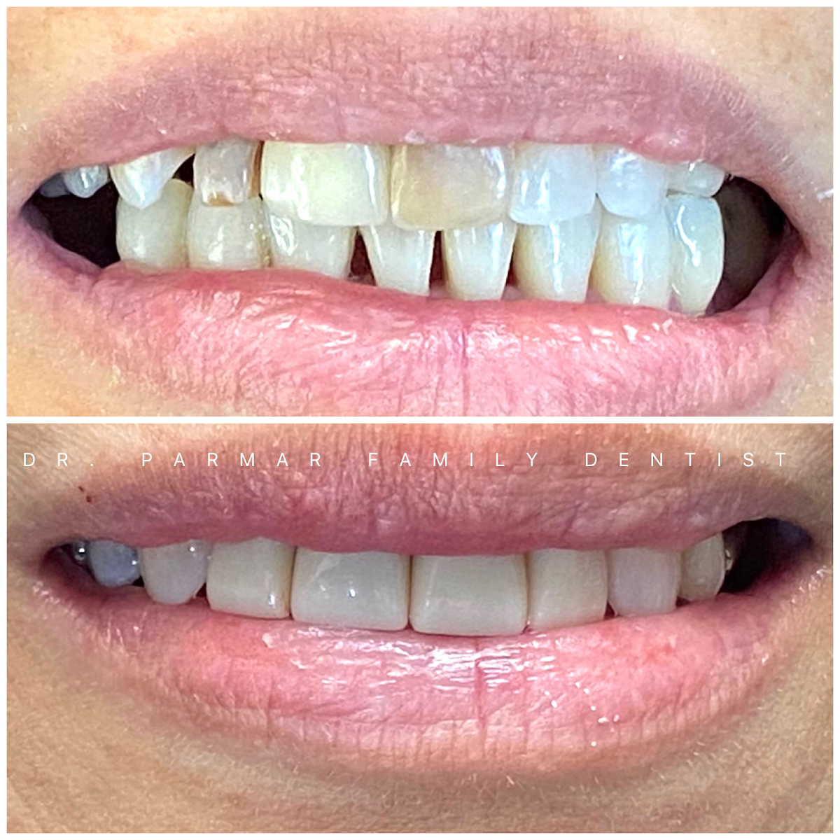 Dr. Parmar Family Dentist photo 3