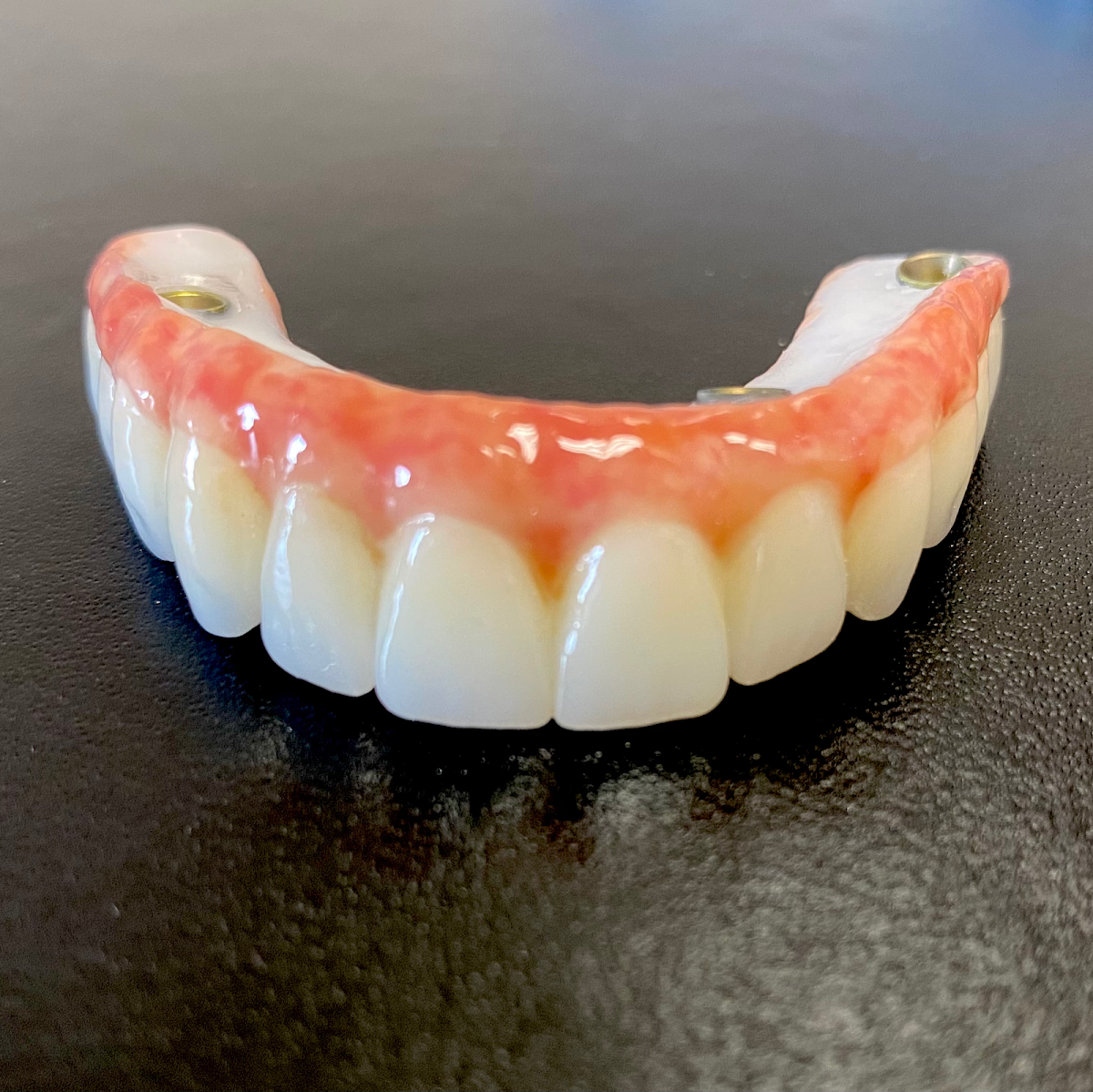 Dr. Parmar Family Dentist photo 6