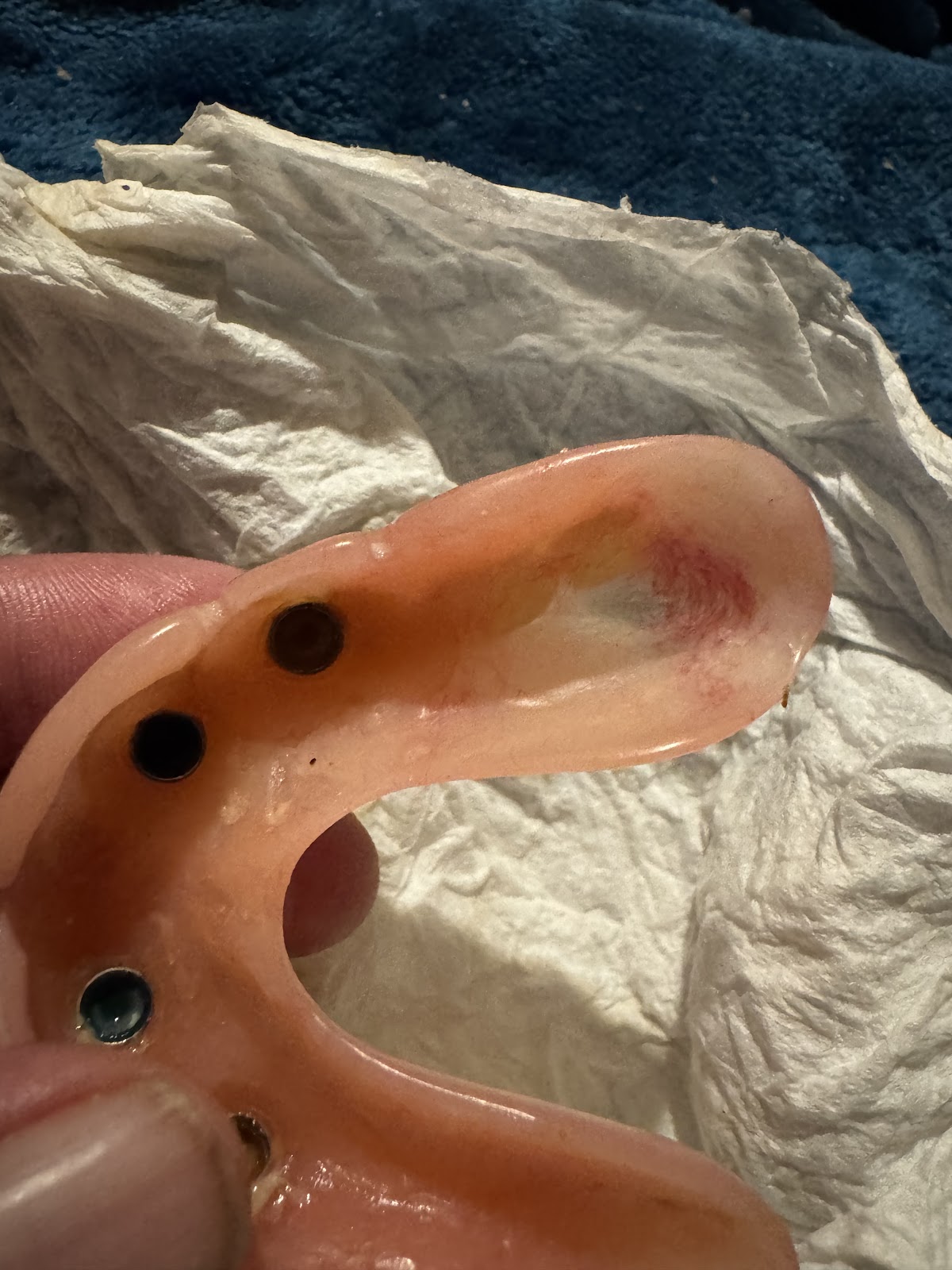 Affordable Dentures & Implants - Northeast Columbia photo 5