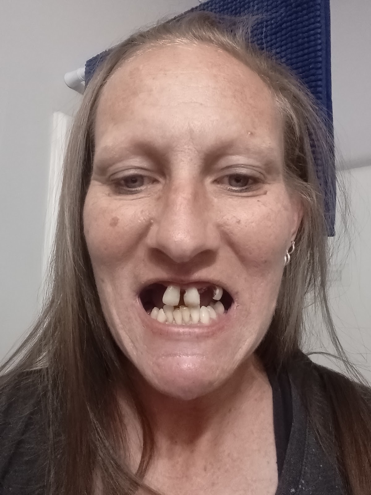 Affordable Dentures & Implants photo 5