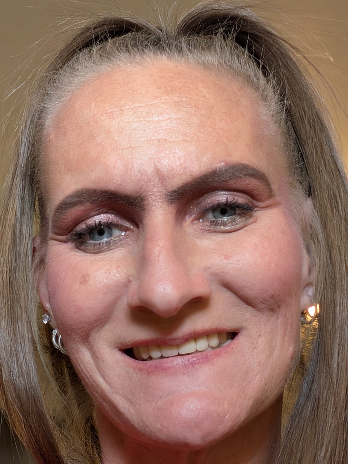 Affordable Dentures & Implants photo 6