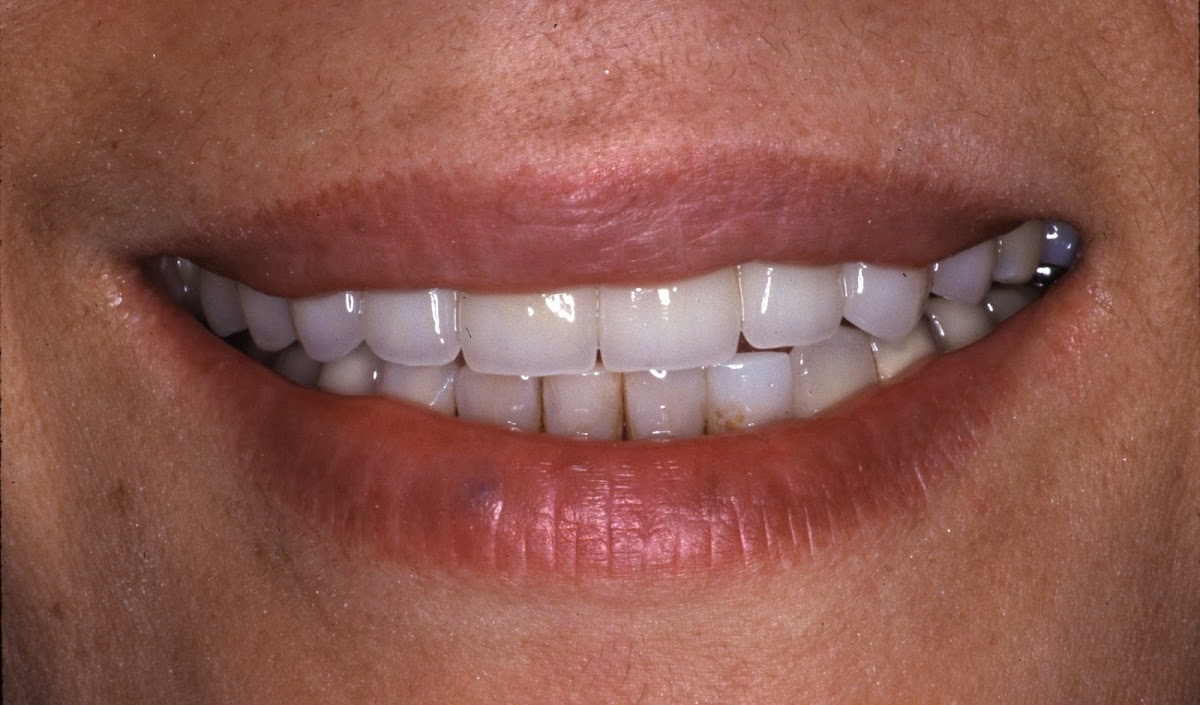 Advanced Restorative Dentistry photo 4