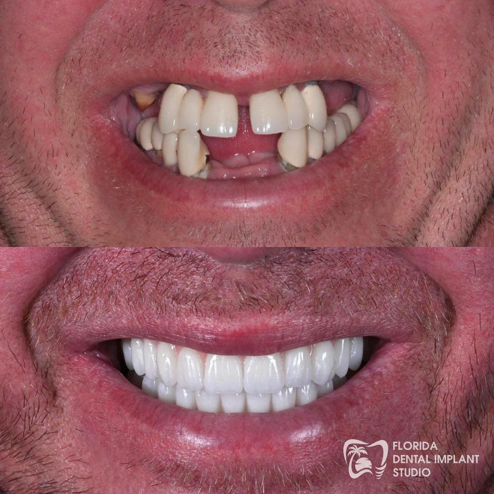 Florida Dental Implant Studio photo 3