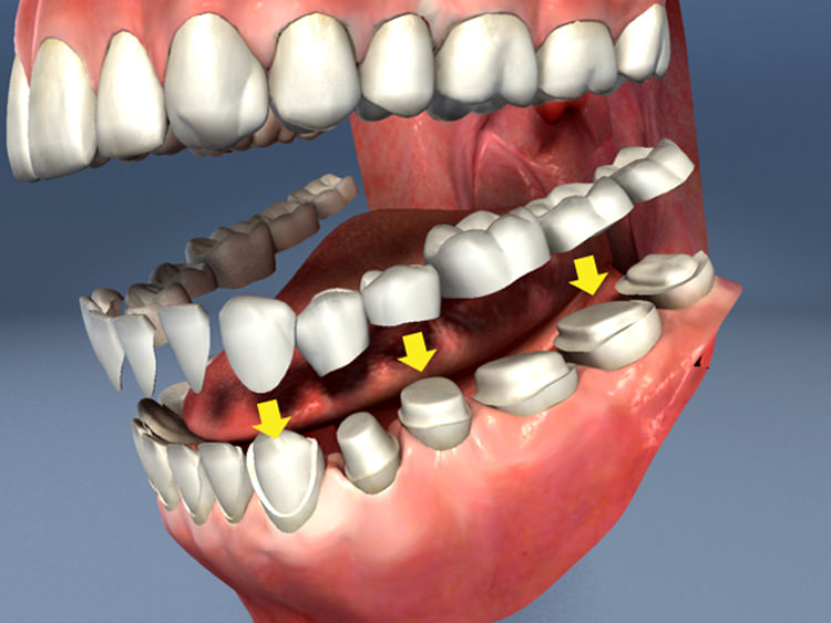 Next Dentistry: Salinas Cosmetic And Dental Implant Center photo 6