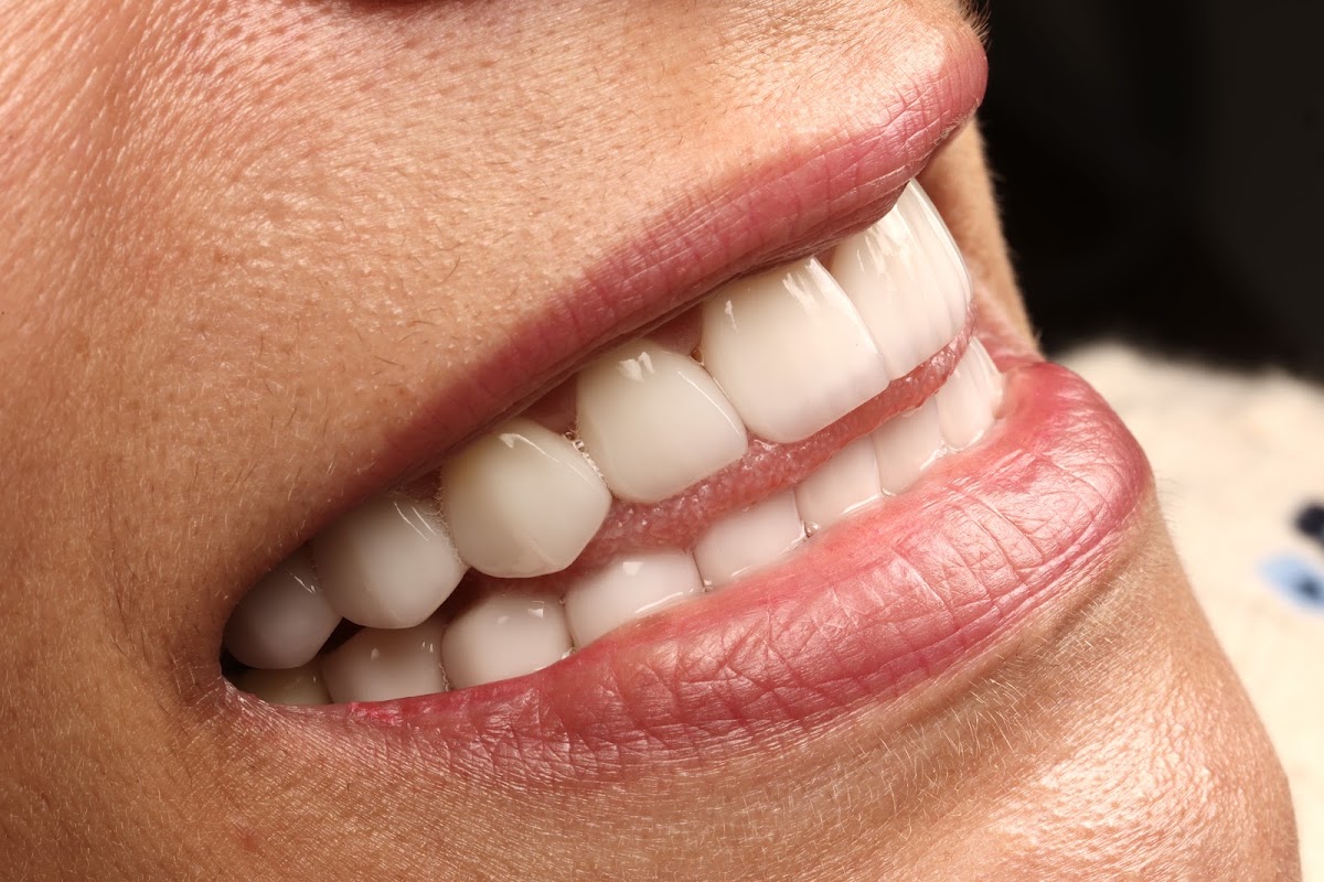 Sapphire Smiles - Dr. Antoun | Leading Cosmetic Dentist in Houston photo 2