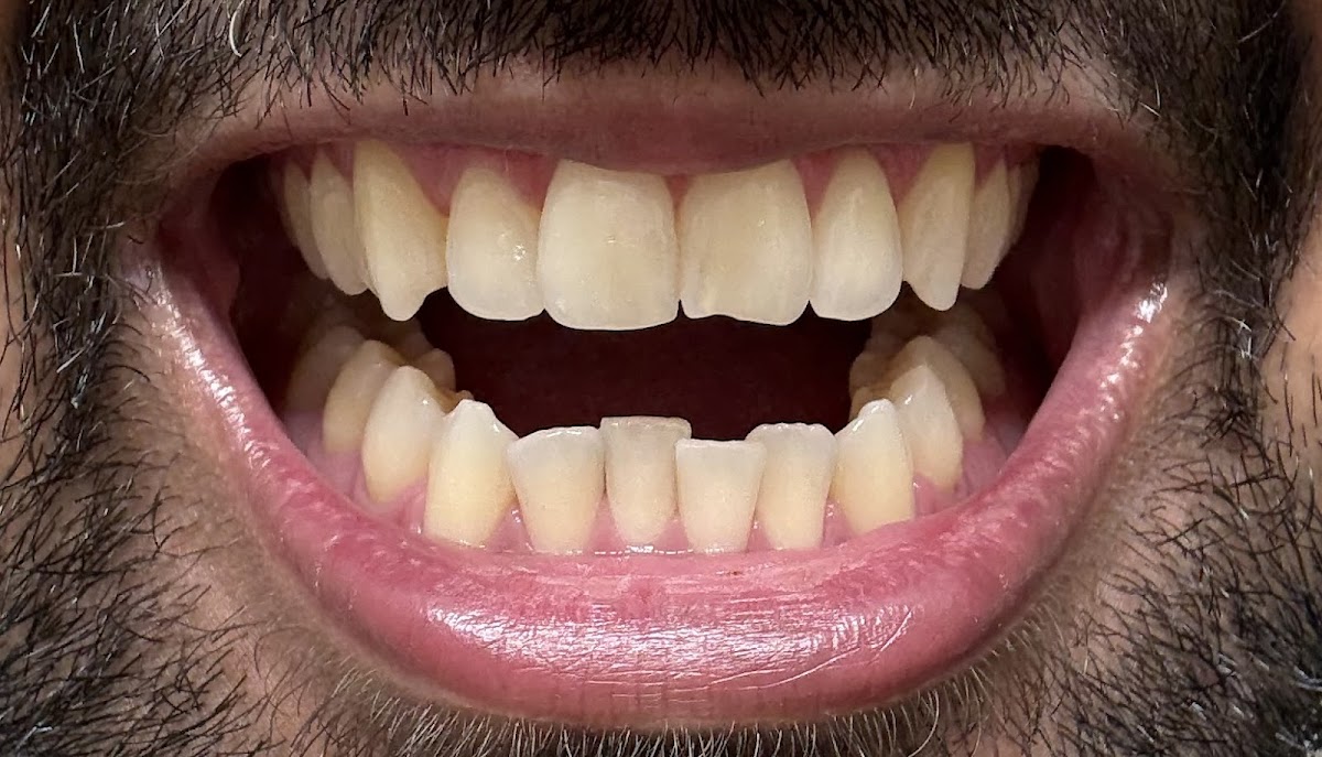 Sapphire Smiles - Dr. Antoun | Leading Cosmetic Dentist in Houston photo 5
