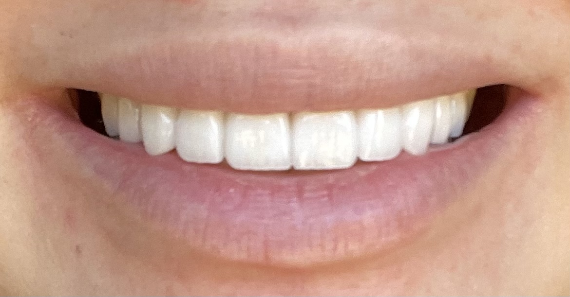 Pacific Dental Care photo 2