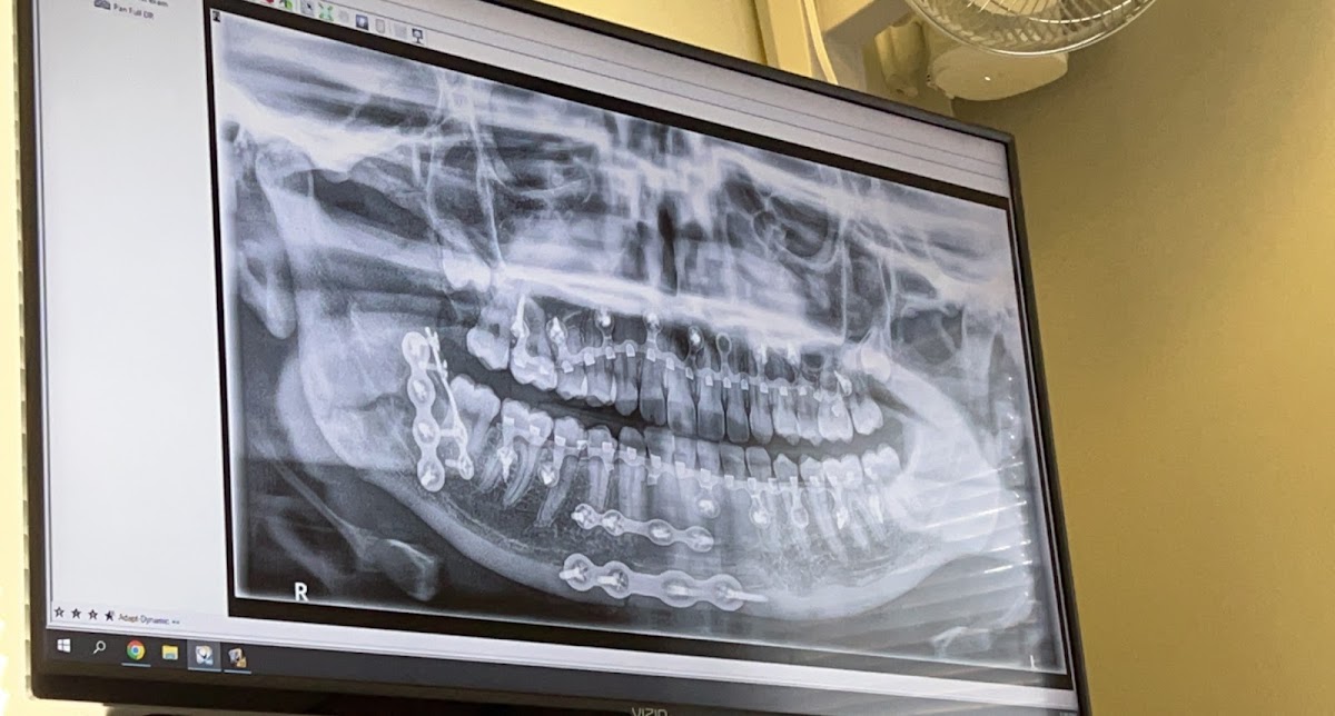 Nhoms: New Hampshire Oral and Maxillofacial Surgery - Concord photo 2