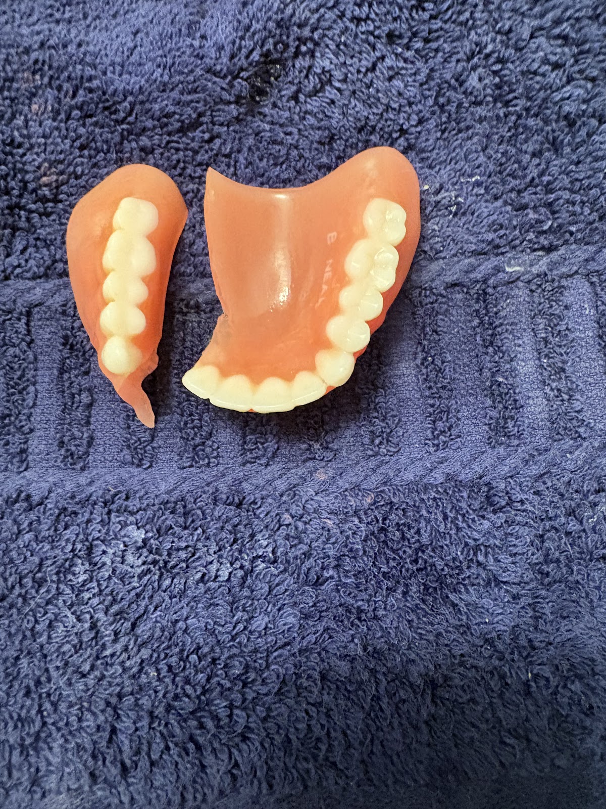 Aspen Dental - Lake Worth photo 3