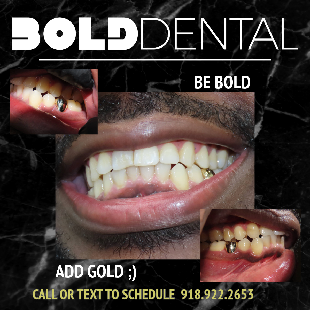 Bold Dental Tulsa photo 6