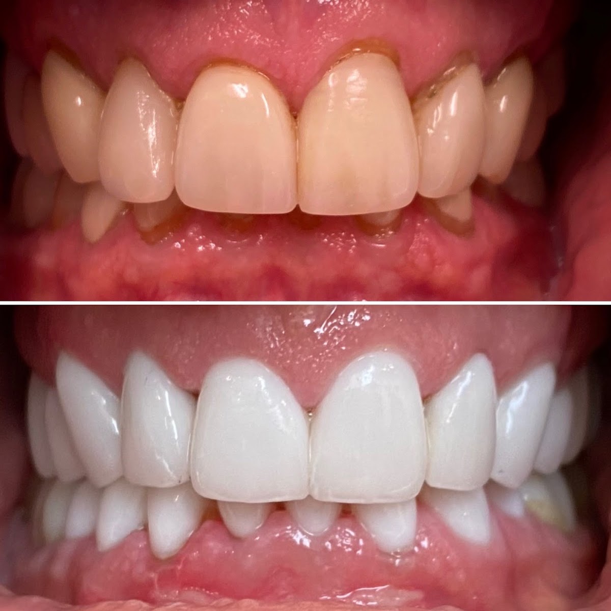 Clifton Dentist - Premiere Family Dental Care photo 2