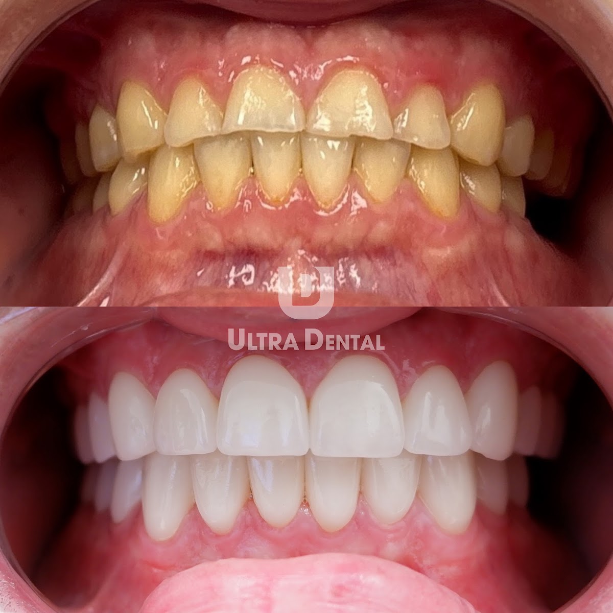 Ultra Dental - Peoria photo 1