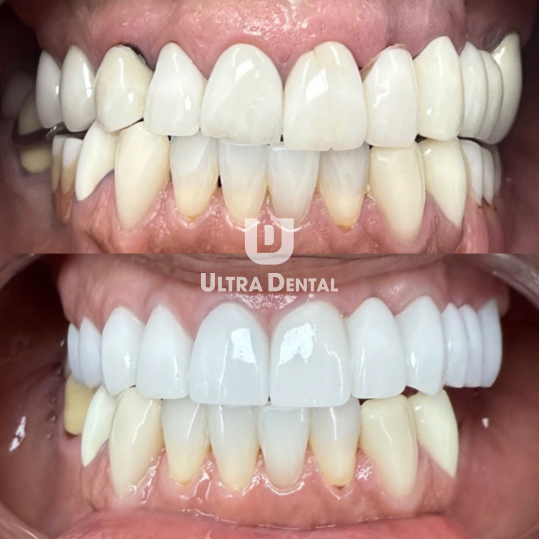 Ultra Dental - Peoria photo 2