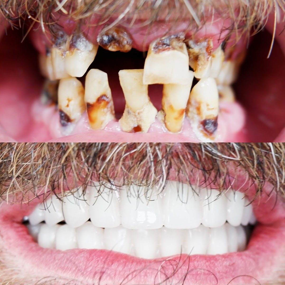 Ultra Dental - Peoria photo 6