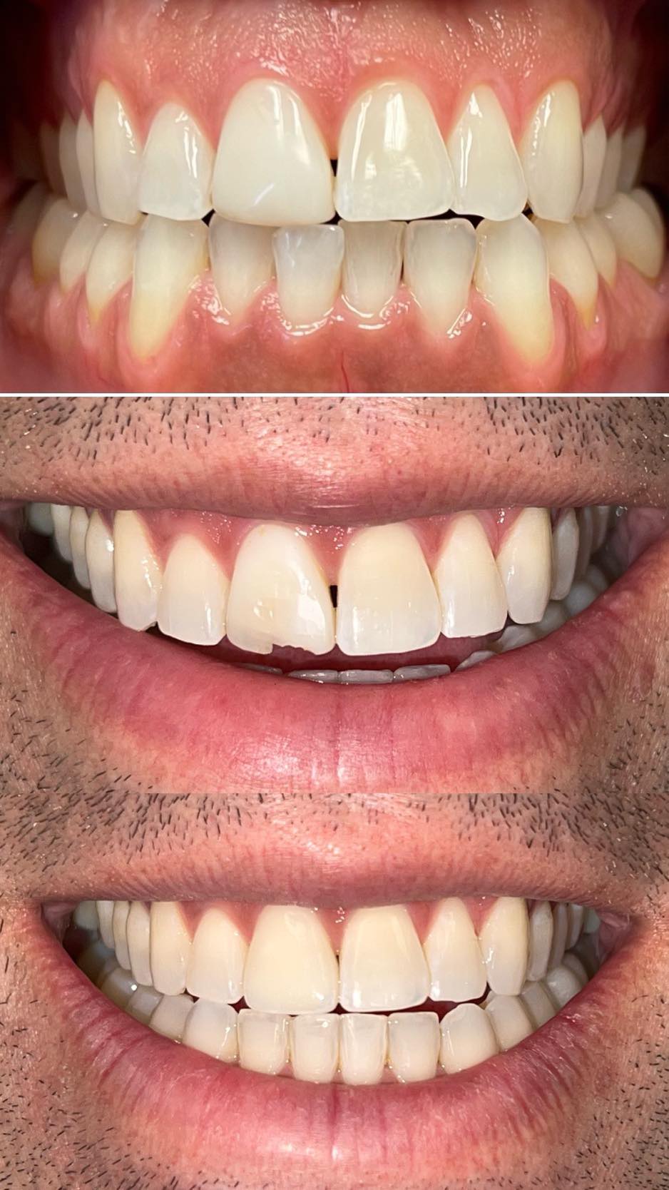Lifetime Family Dental - Implant and General Dentistry photo 4