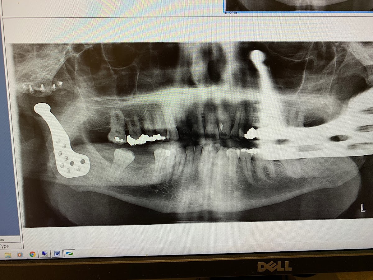 Southwest Oral Surgery & Dental Implants photo 3