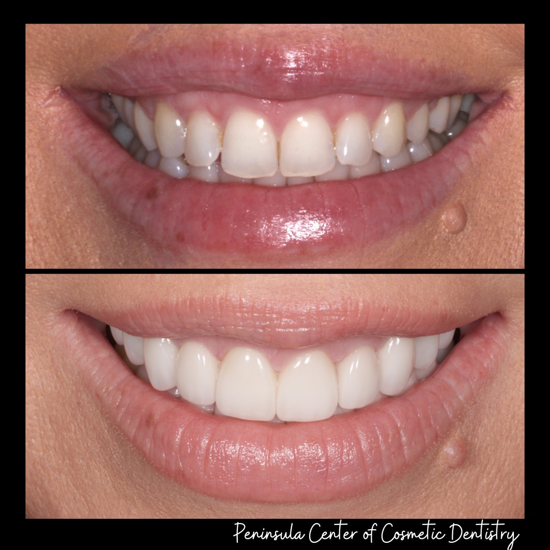 Peninsula Center Of Cosmetic Dentistry photo 1