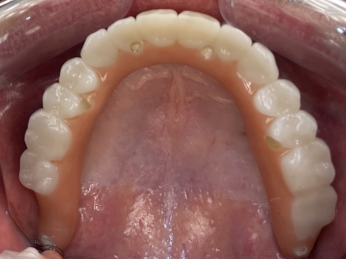 Affordable Dentures & Implants - Kinston photo 6