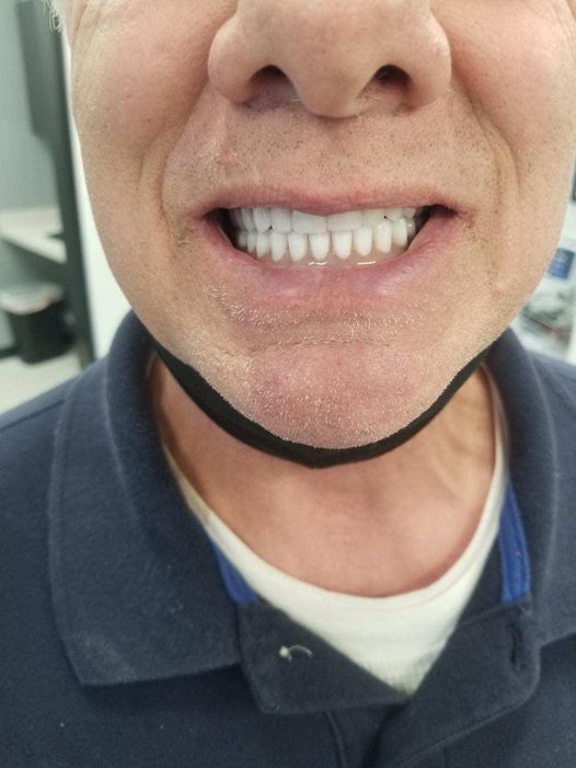 Affordable Dentures & Implants - Jonesboro photo 4