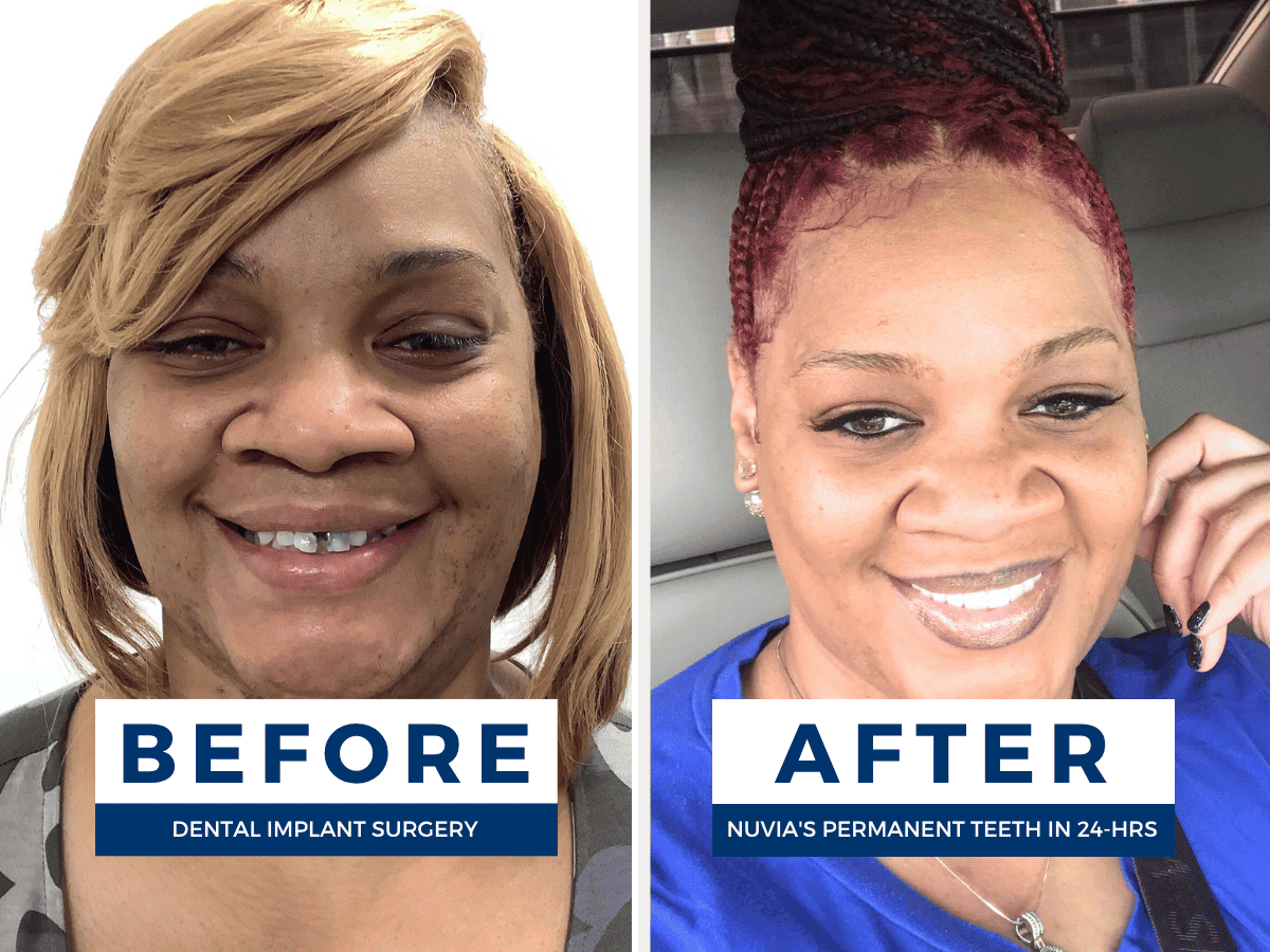 Nuvia Dental Implant Center - Kansas City photo 2