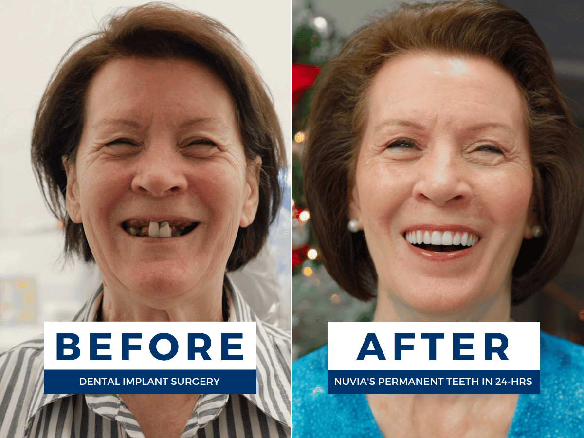 Nuvia Dental Implant Center - Kansas City photo 4
