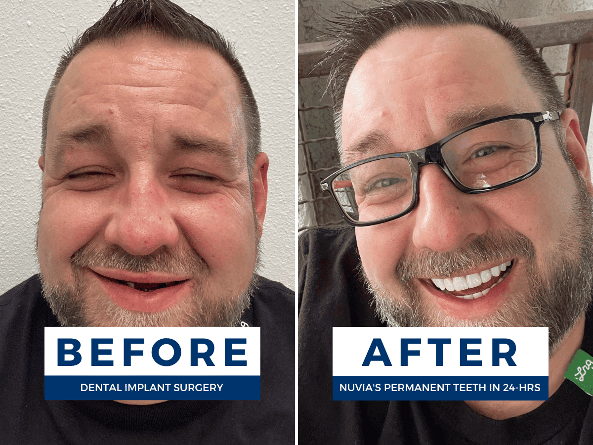 Nuvia Dental Implant Center - Kansas City photo 5