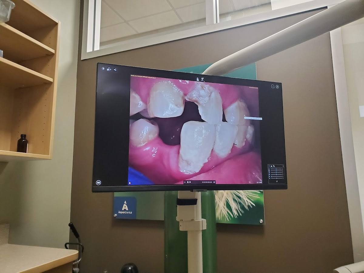 Aspen Dental - Colorado Springs photo 3