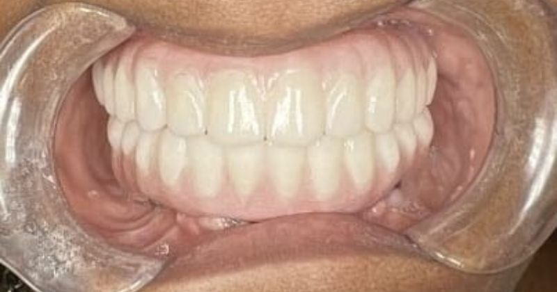 Nulife Dental Implants photo 2