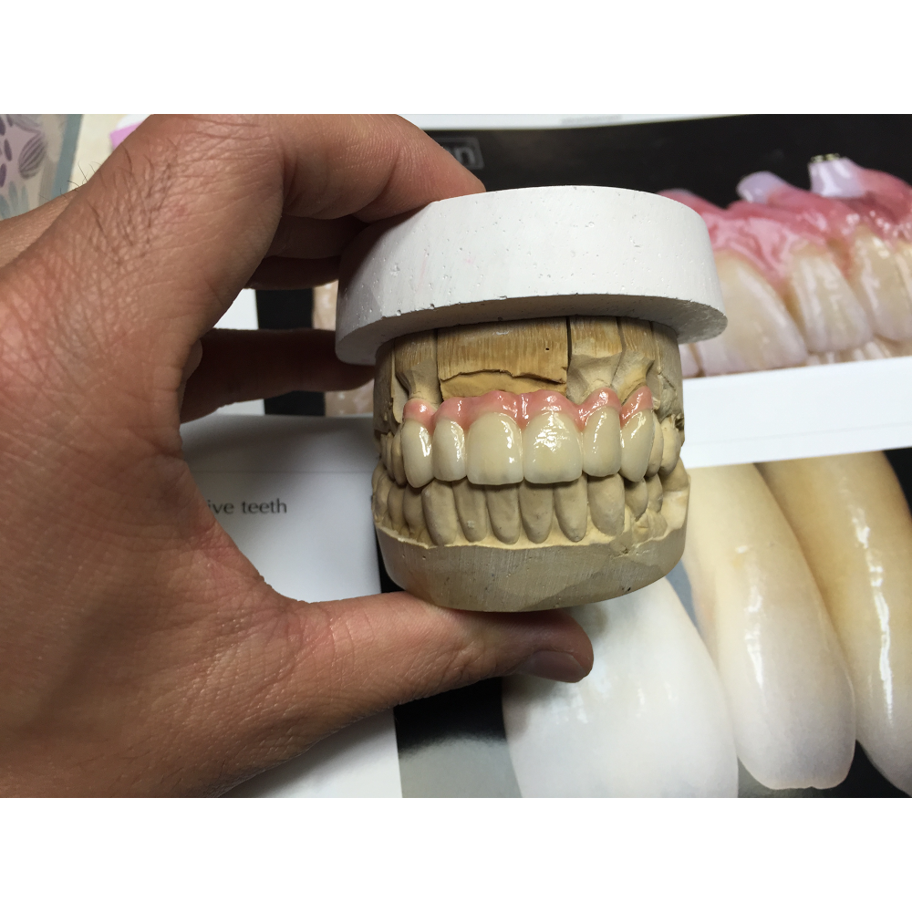 Vermont Dental Ceramics photo 2