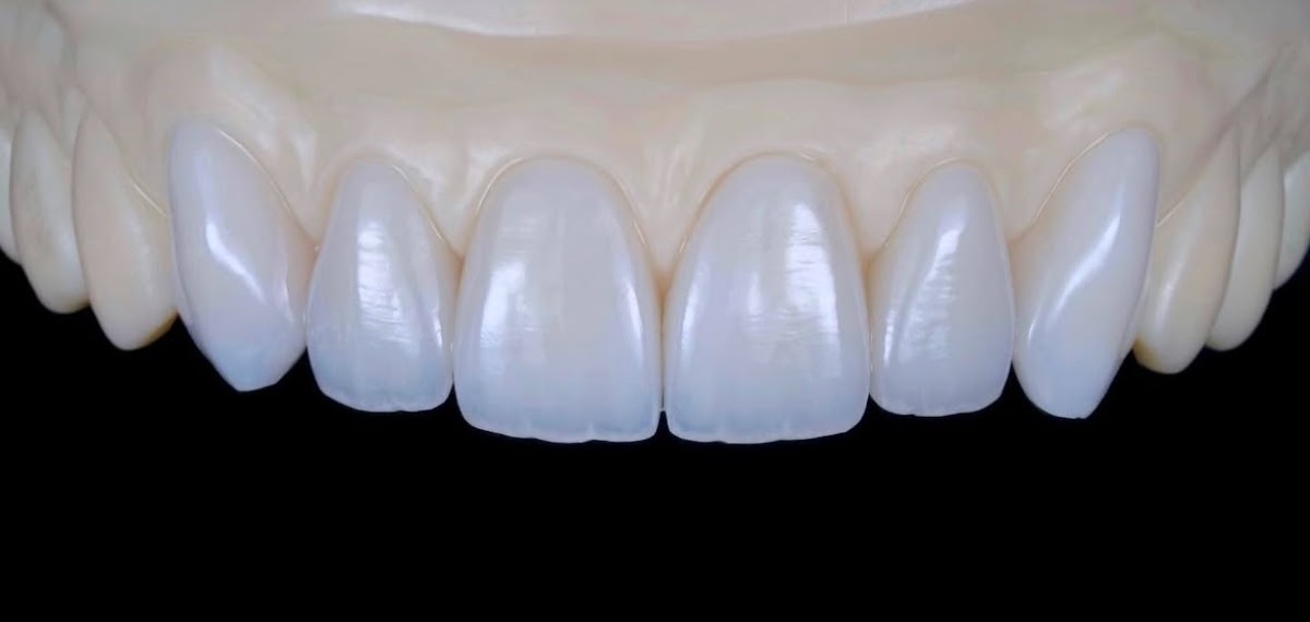 Over the Mountain Dentistry - Dr. Luis Abrahante photo 3