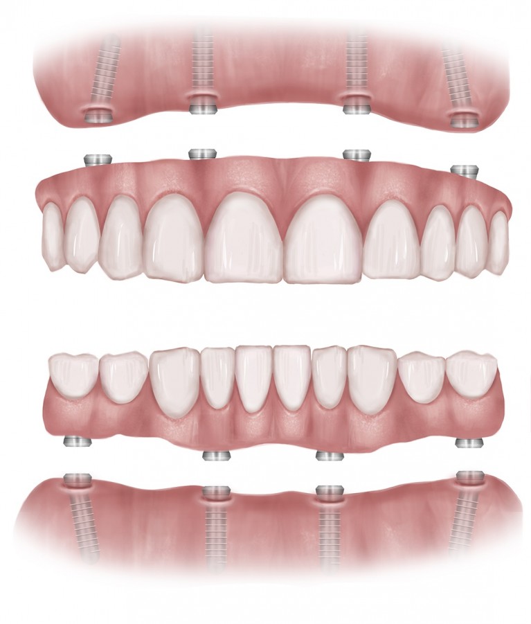 Florida Dental Implant Center photo 1