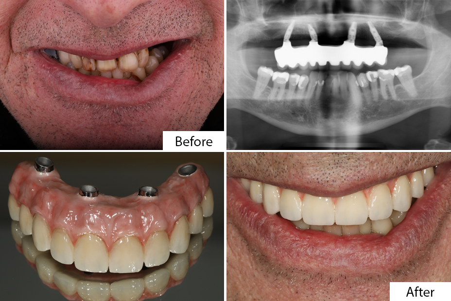 Florida Dental Implant Center photo 2