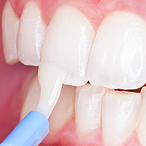 Naples General & Cosmetic Dentistry LLC photo 4