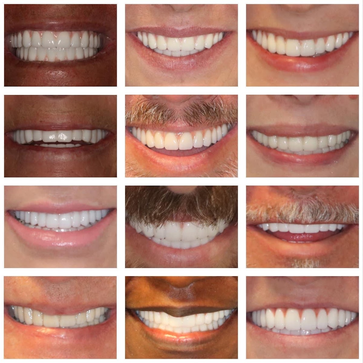 Smart Arches Dental Implants - Bartonsville photo 3