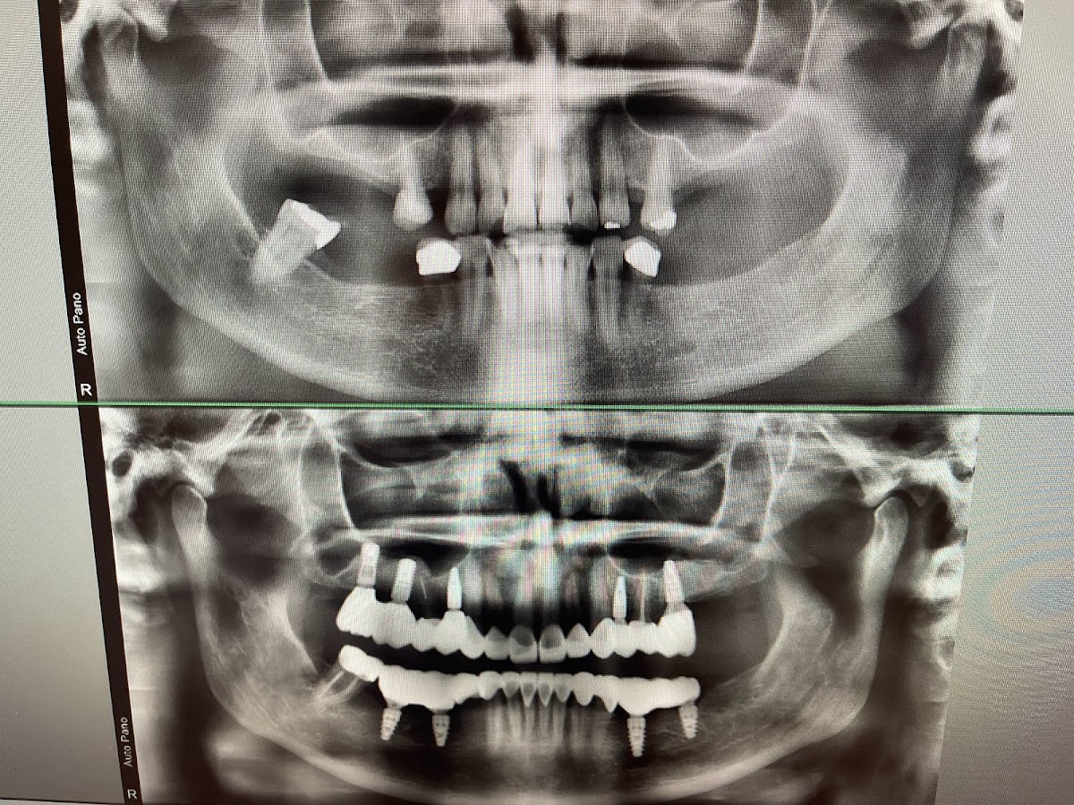 Myrtle Grove Implant and Family Dentistry photo 1